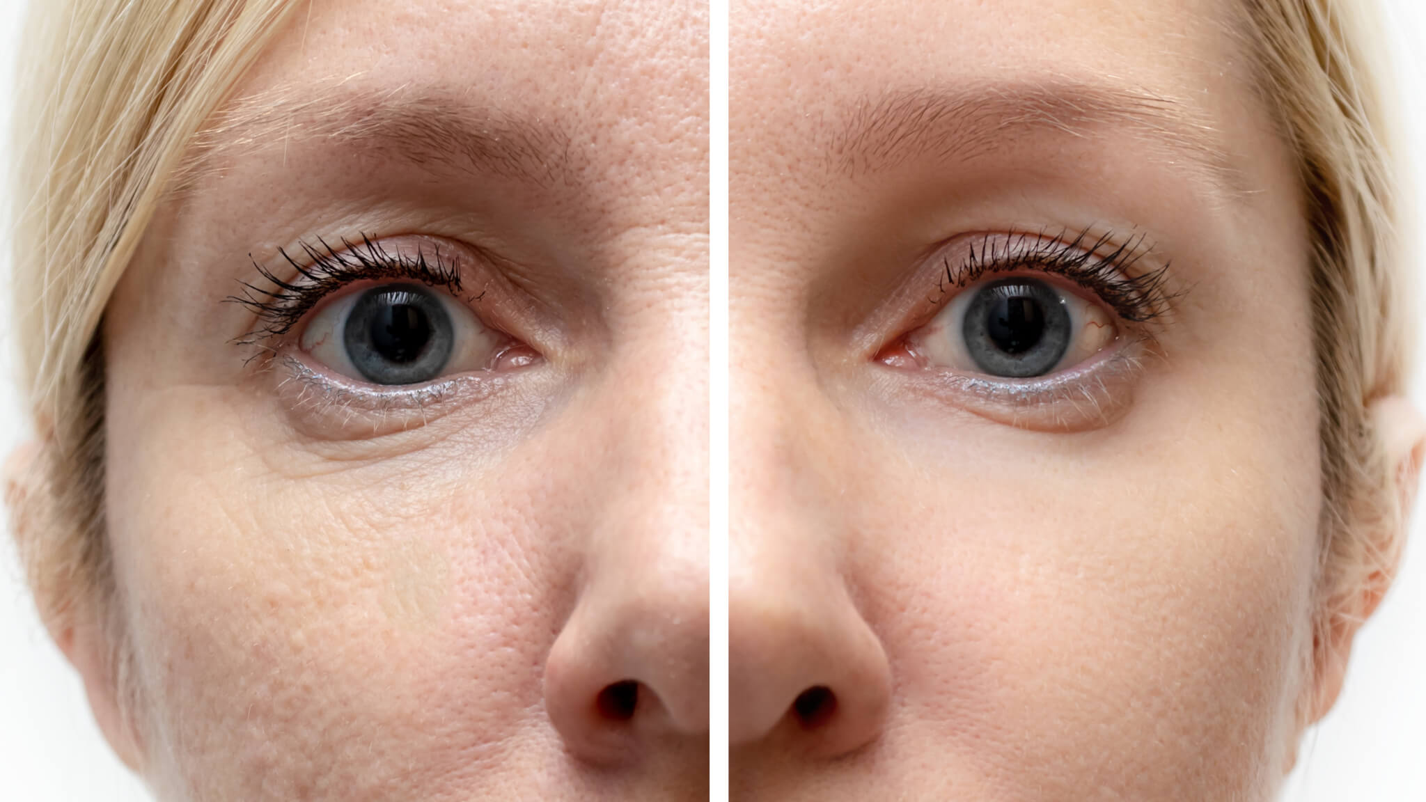 What Type of Cosmetic Surgery Should I Get to Have a Slimmer Face?